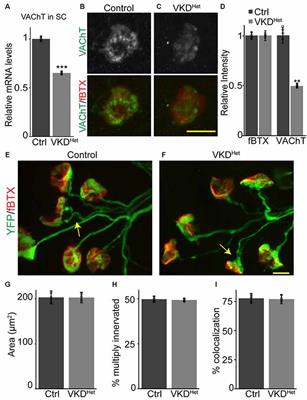 Attenuating Cholinergic Transmission Increases the Number of Satellite Cells and Preserves Muscle Mass in Old Age